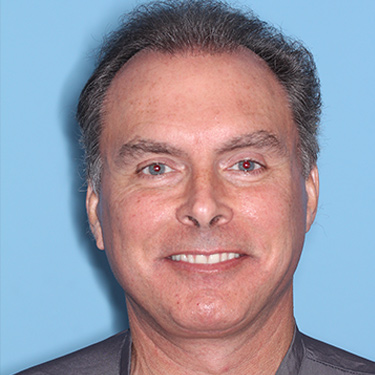 Case--36831 | After Facelift and Neck Lift for Men 1